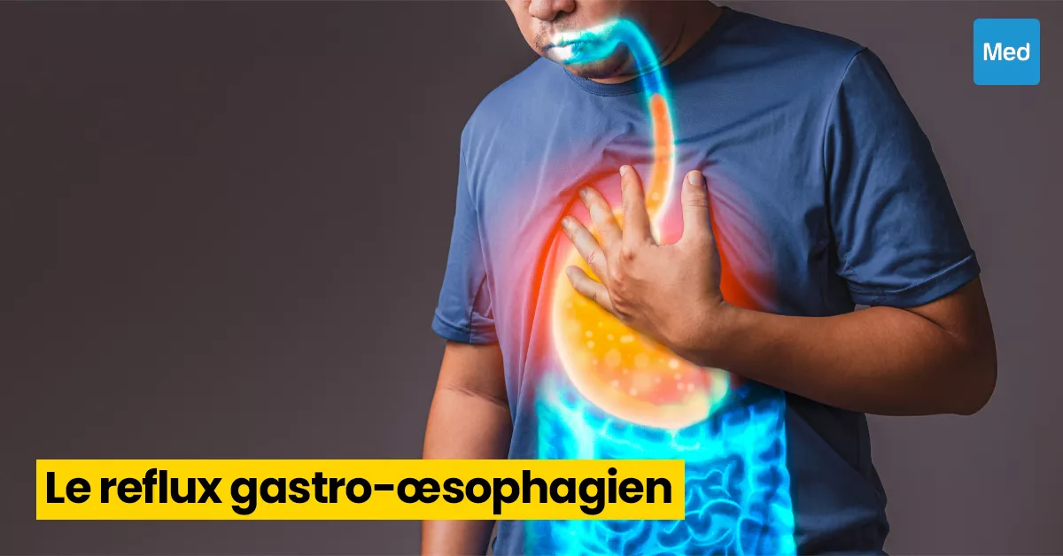 Le Reflux Gastro-Œsophagien (RGO) : comprendre et soulager ce trouble digestif fréquent